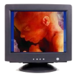 Fetus Picture on PC Monitor
